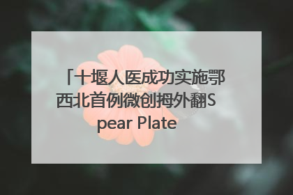 十堰人医成功实施鄂西北首例微创拇外翻Spear Plate髓内板矫形术
